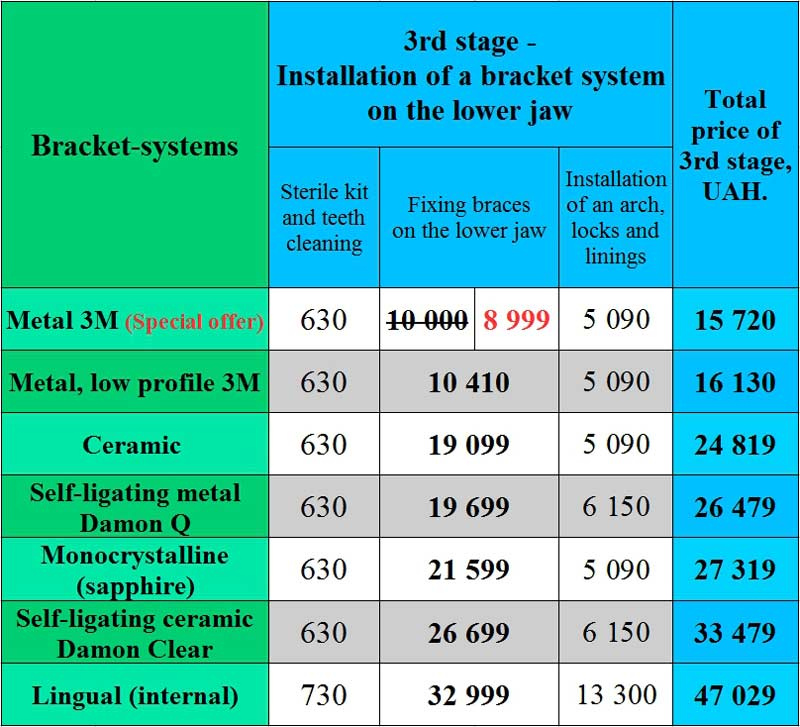 Installation of a bracket system price Kiev LumiDent